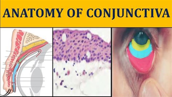 What is the meaning of suffusive?