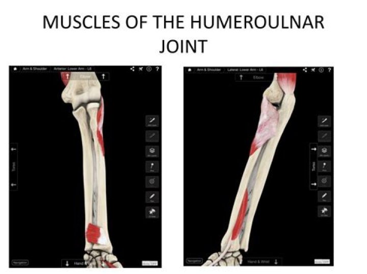 What kind of joint is the humeroulnar joint?