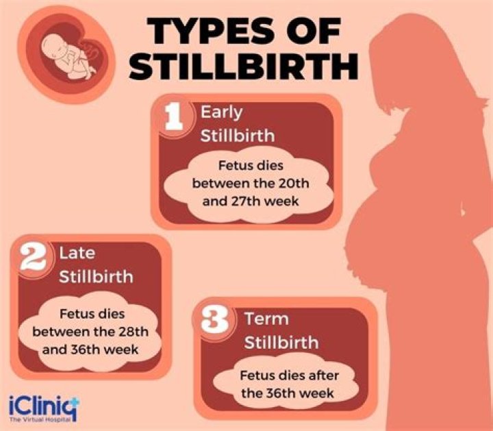What stillborn baby means?