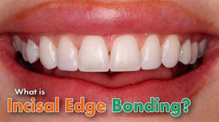 Whats a incisal edge?