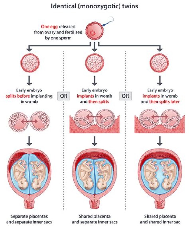 When do monozygotic twins split?