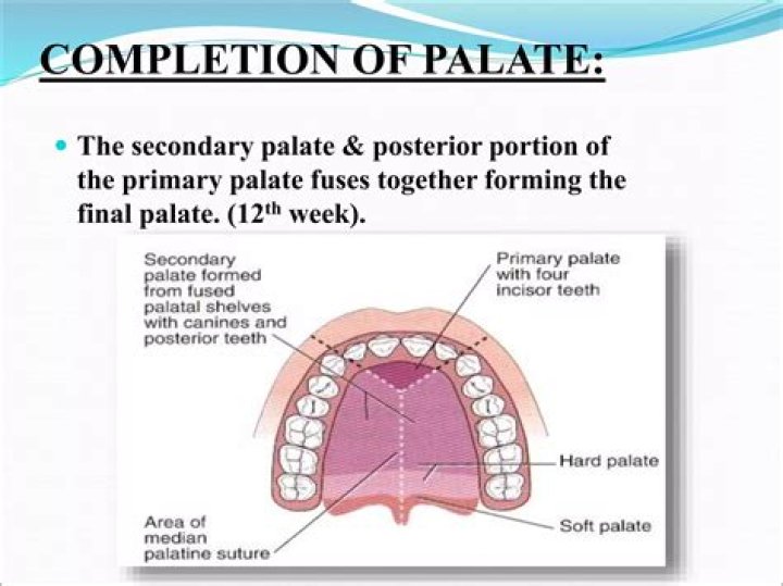 When does palate form?