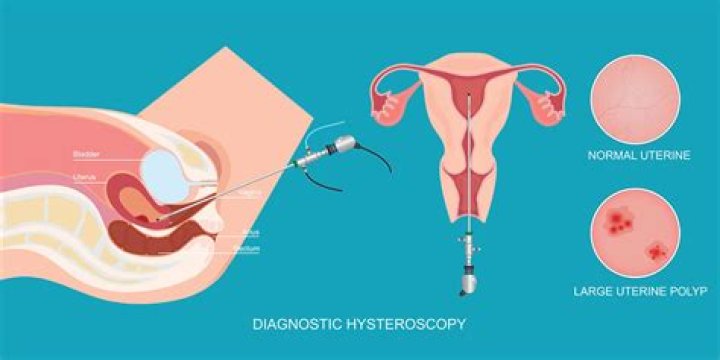 When is a d&c performed?