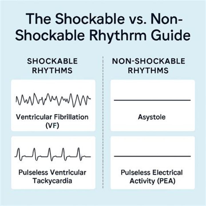When is a rhythm shockable?