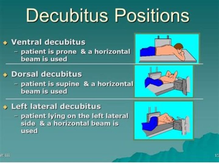 When is decubitus position used?