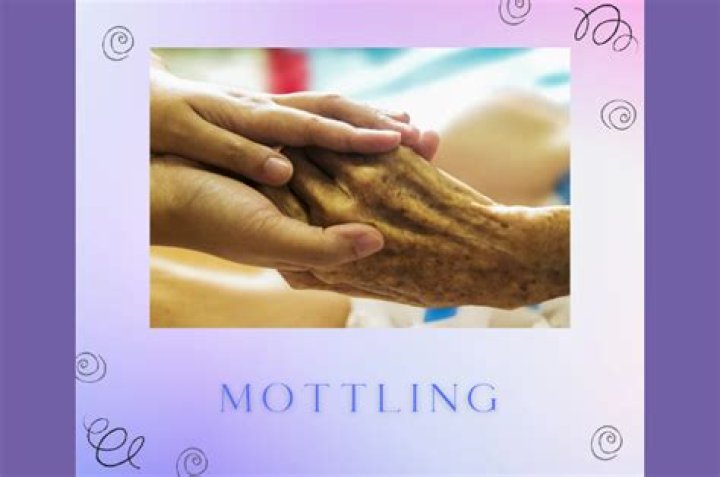 When mottling starts how long before death?