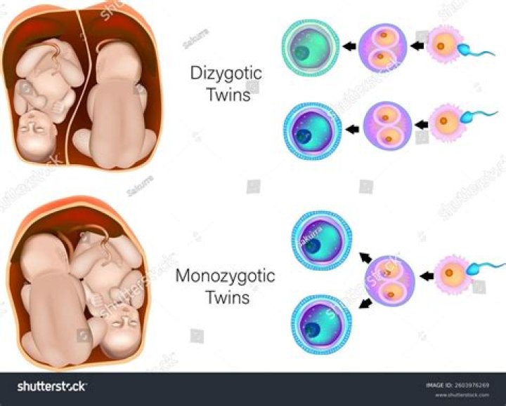 Where does monozygotic twins occur?