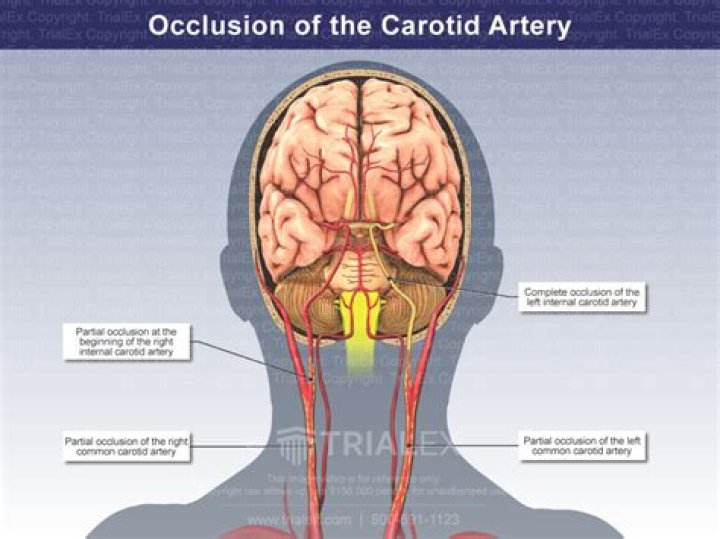 Where does occluded come from?