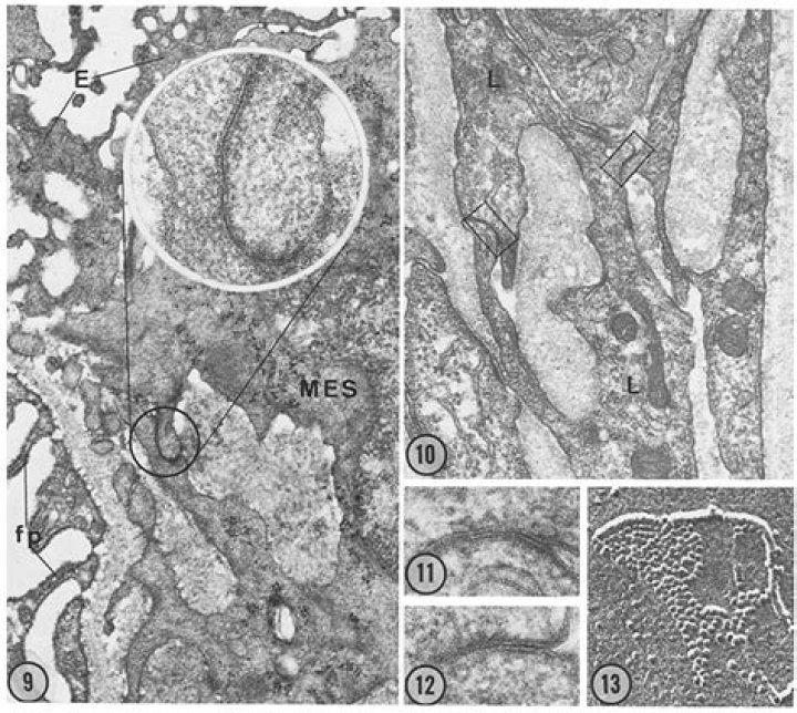 Where is the lacis cells located?