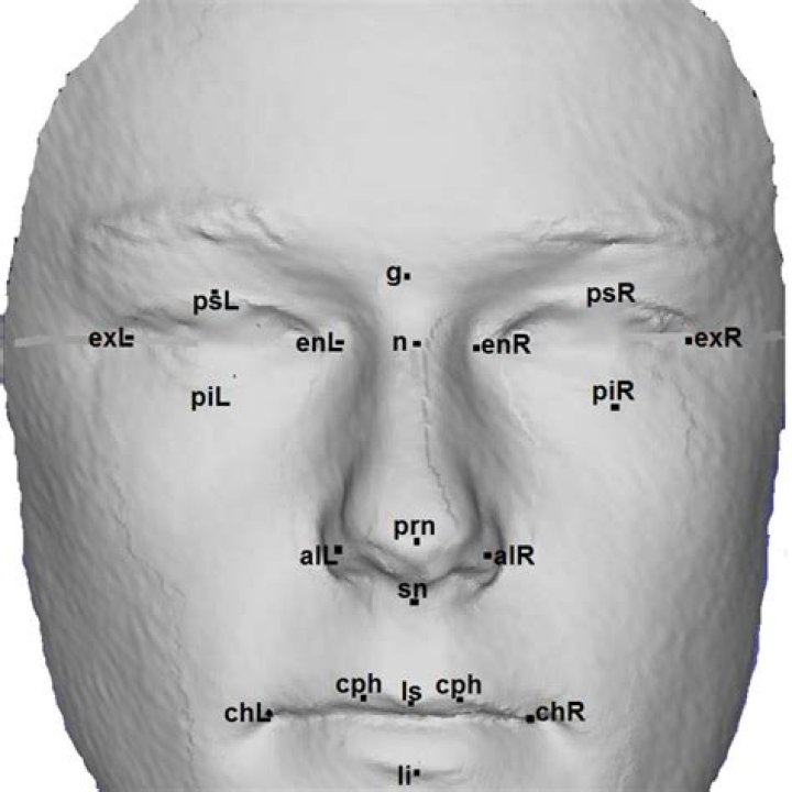 Where is the philtrum located on the face?