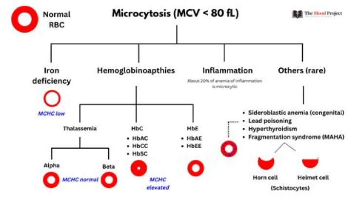 Which anemias are microcytic?