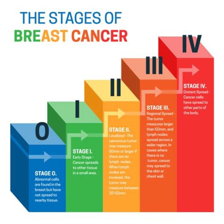 Which breast cancer is bilateral?