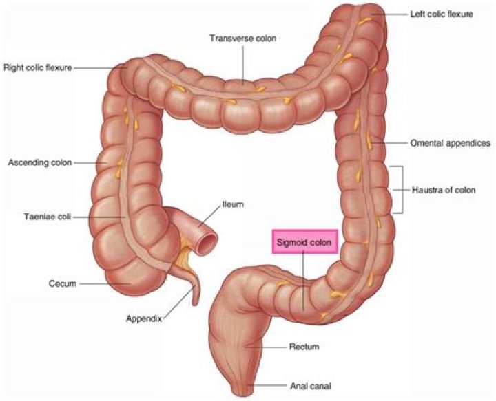 Which side is the sigmoid colon on?