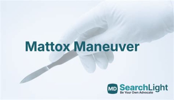 Who is mattox maneuver?