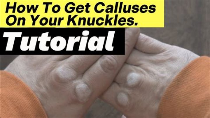 Why do bulimics get calloused knuckles?