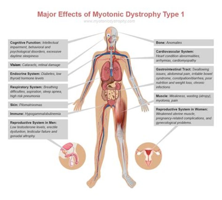 Why does myotonic dystrophy occur?
