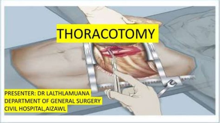 Why is a thoracotomy so painful?