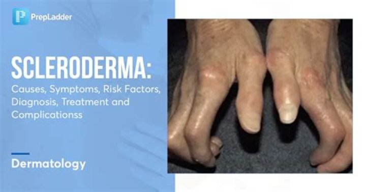 Why is scleroderma a problem?