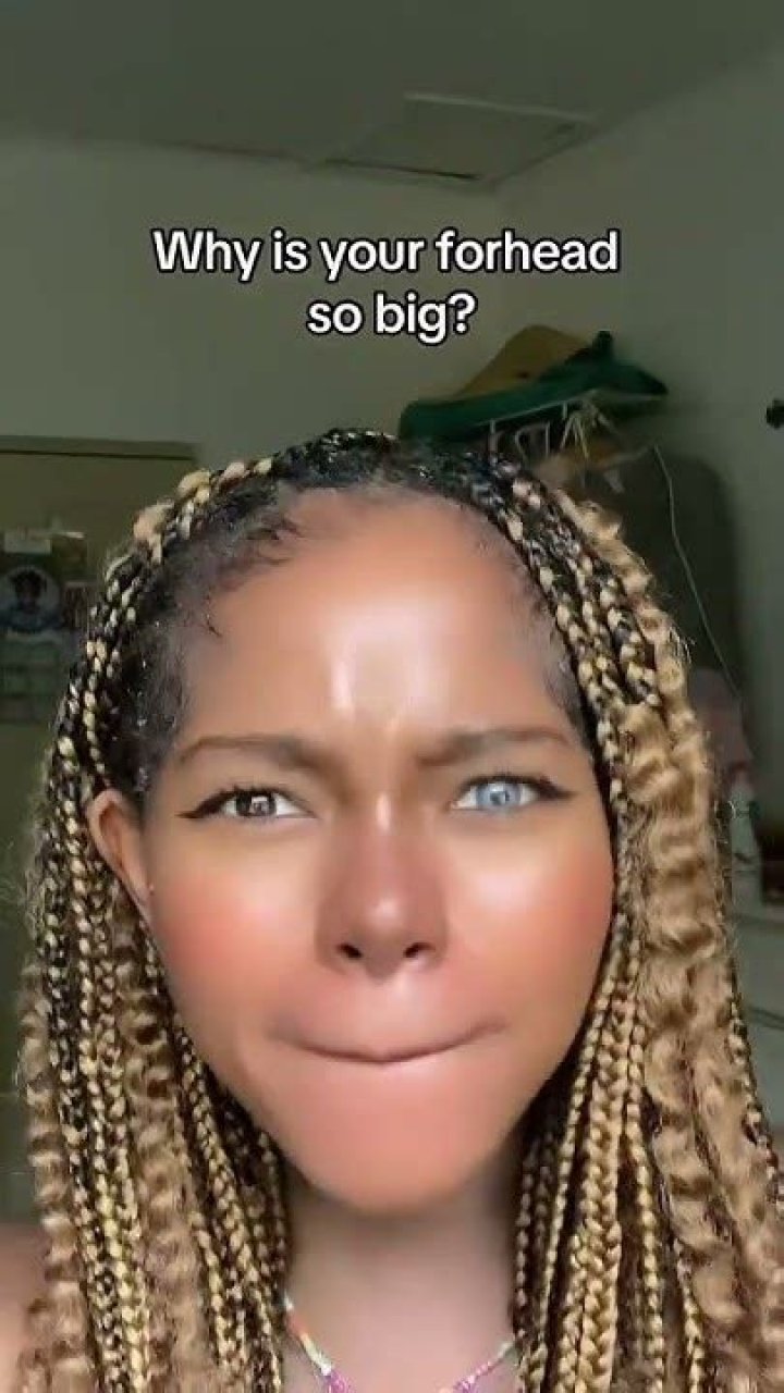 Why my forehead so big?