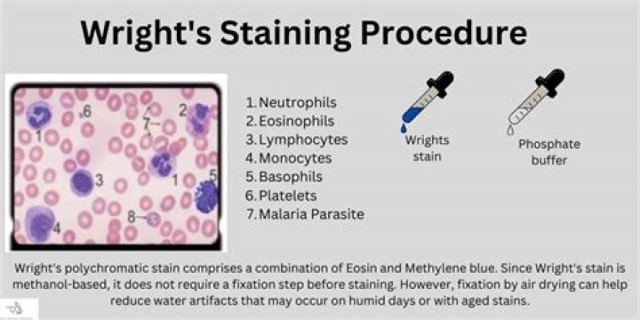 Why stain is important?